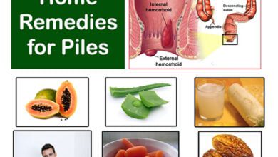 home remedies for piles