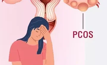Unlocking the Mysteries of PCOS e1693415228879